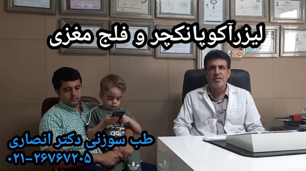 لیزرآکوپانکچر و عوارض فلج مغزی در کودکان