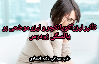 نمونه بالینی درمان تنبلی تخمدان و یائسگی زودرس با لیزرآکوپانکچر