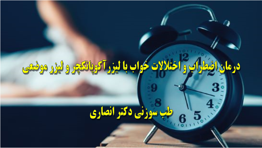 درمان اضطراب و مشکلات خواب با طب سوزنی لیزری و لیزر موضعی