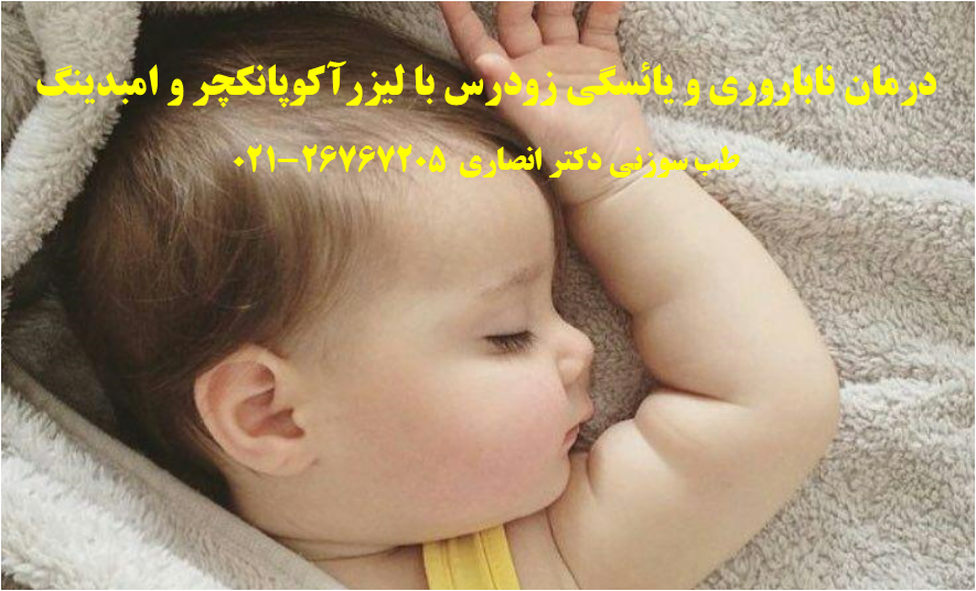 نمونه  بالینی درمان ناباروری و یائسگی زودرس با لیزرآکوپانکچر و امبدینگ