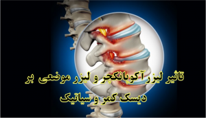 تأثیر لیزرآکوپانکچر و لیزر موضعی بر درد کمر و سیاتیک تأثیر لیزرآکوپانکچر و لیزر موضعی بر درد کمر و سیاتیک