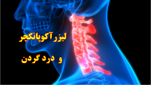 درد گردن و لیزر آکوپانکچر