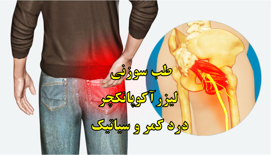 کمردرد و درد سیاتیک کمردرد و درد سیاتیک