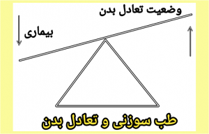 تعادل بدن با طب سوزنی