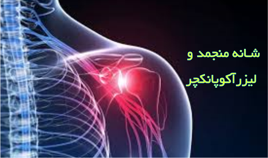 شانه منجمد (Frozen Shoulder) یا شانه یخزده