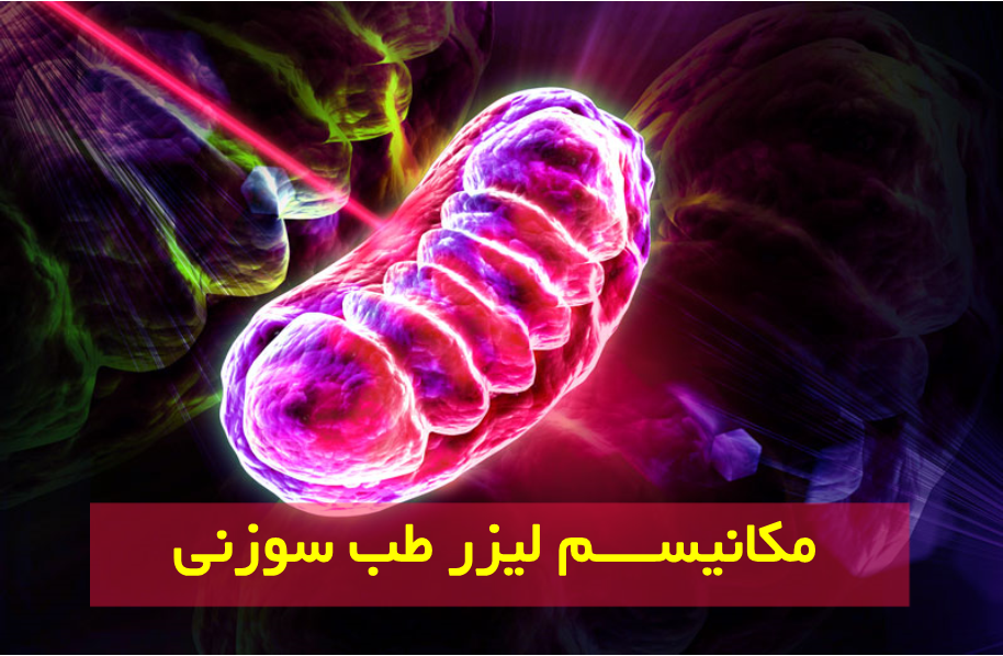 مکانیسم لیزر آکوپانکچر و لیزر موضعی کم توان