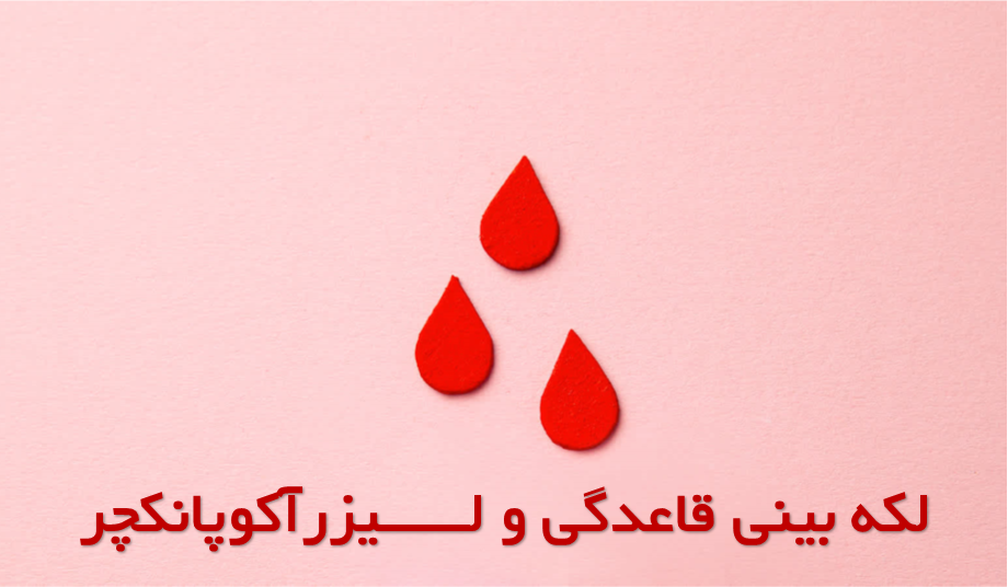 لکه بینی قاعدگی لکه بینی قاعدگی