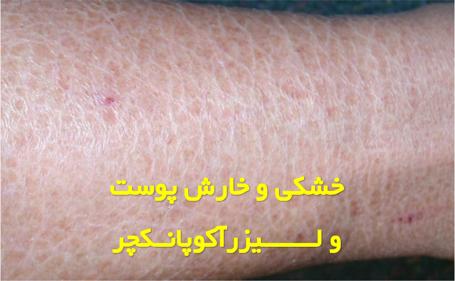 خارش و خشکی پوست