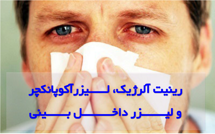 رینیت آلرژیک و لیزر بینی رینیت آلرژیک و لیزر بینی