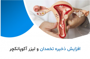 افزایش ذخیره تخمدان