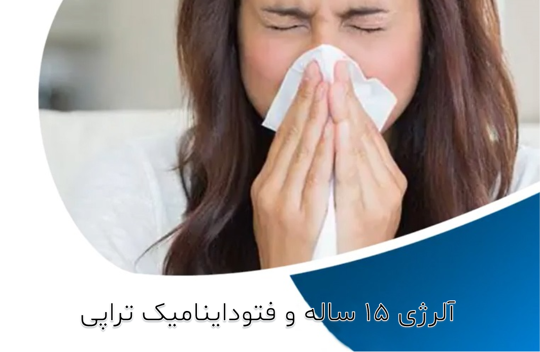 آلرژی 15 ساله و درمان با فتوداینامیک تراپی