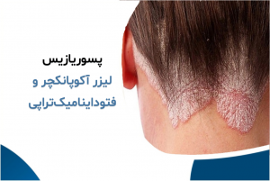 پسوریازیس و خارش شدید پوست