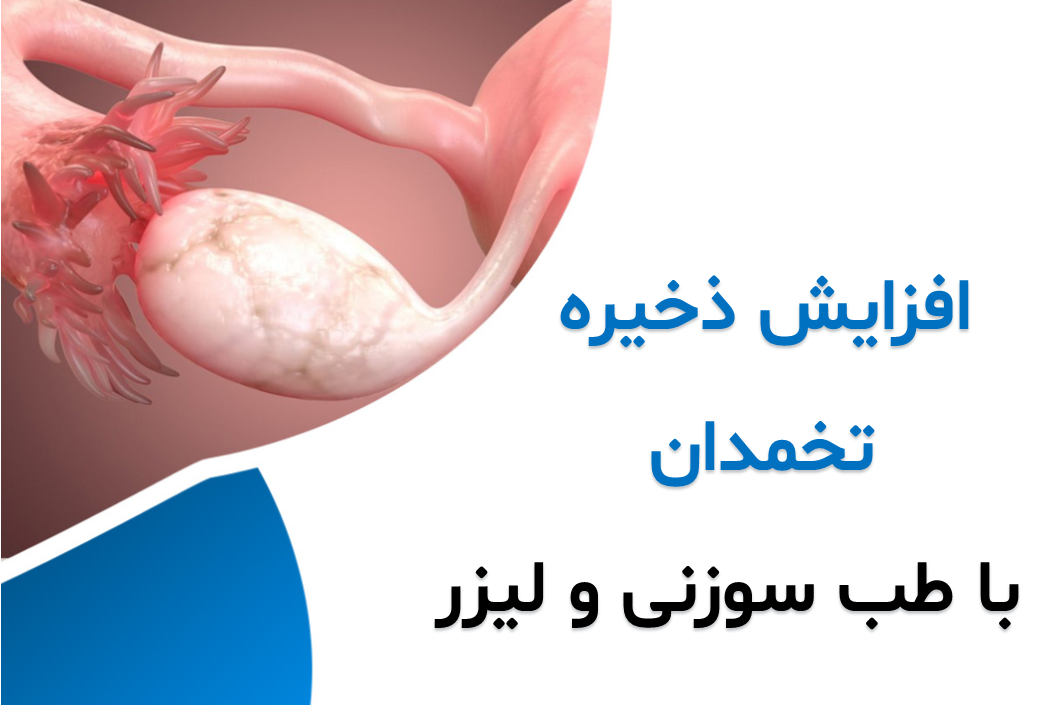 افزایش سه برابر ذخیره تخمدان