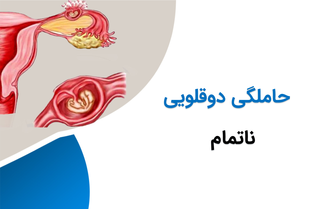 حاملگی دوقلویی در یائسگی زودرس