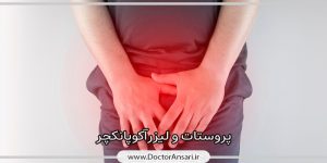 پروستات و طب سوزنی لیزری پروستات و طب سوزنی لیزری