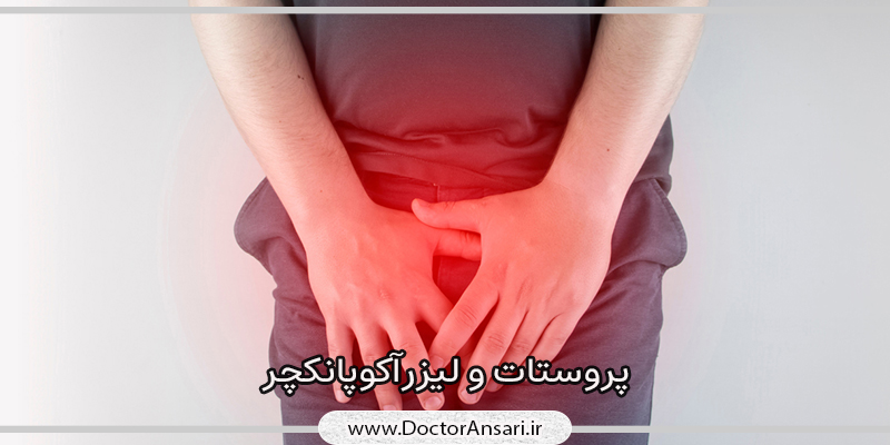 پروستات و طب سوزنی لیزری
