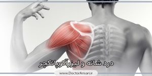 درمان درد شانه و گردن درمان درد شانه و گردن