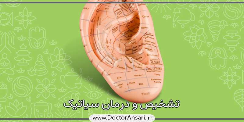 تشخیص و درمان سیاتیک تشخیص و درمان سیاتیک
