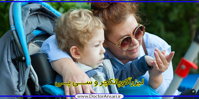 فلج مغزی (سی پی) خفیف و طب سوزنی فلج مغزی (سی پی) خفیف و طب سوزنی