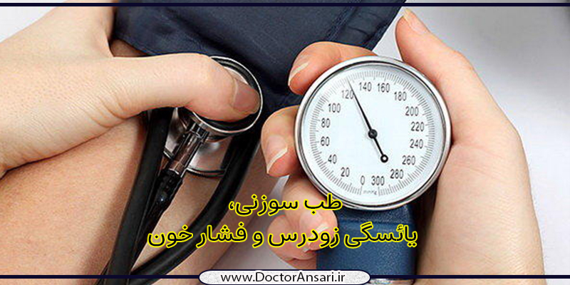 یائسگی زودرس، فشار خون و درمان یائسگی زودرس، فشار خون و درمان