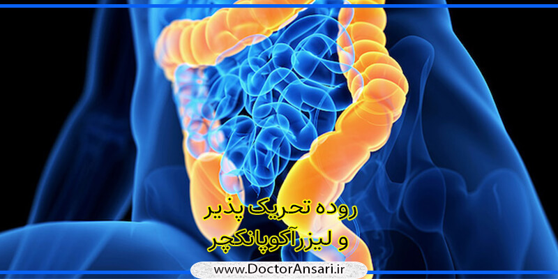 آیا روده تحریک پذیر درمان می شود؟ آیا روده تحریک پذیر درمان می شود؟