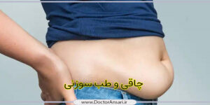 کاهش وزن و لاغری (بدون رژیم) کاهش وزن و لاغری (بدون رژیم)