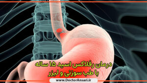 درمان رفلاکس مزمن 15 ساله