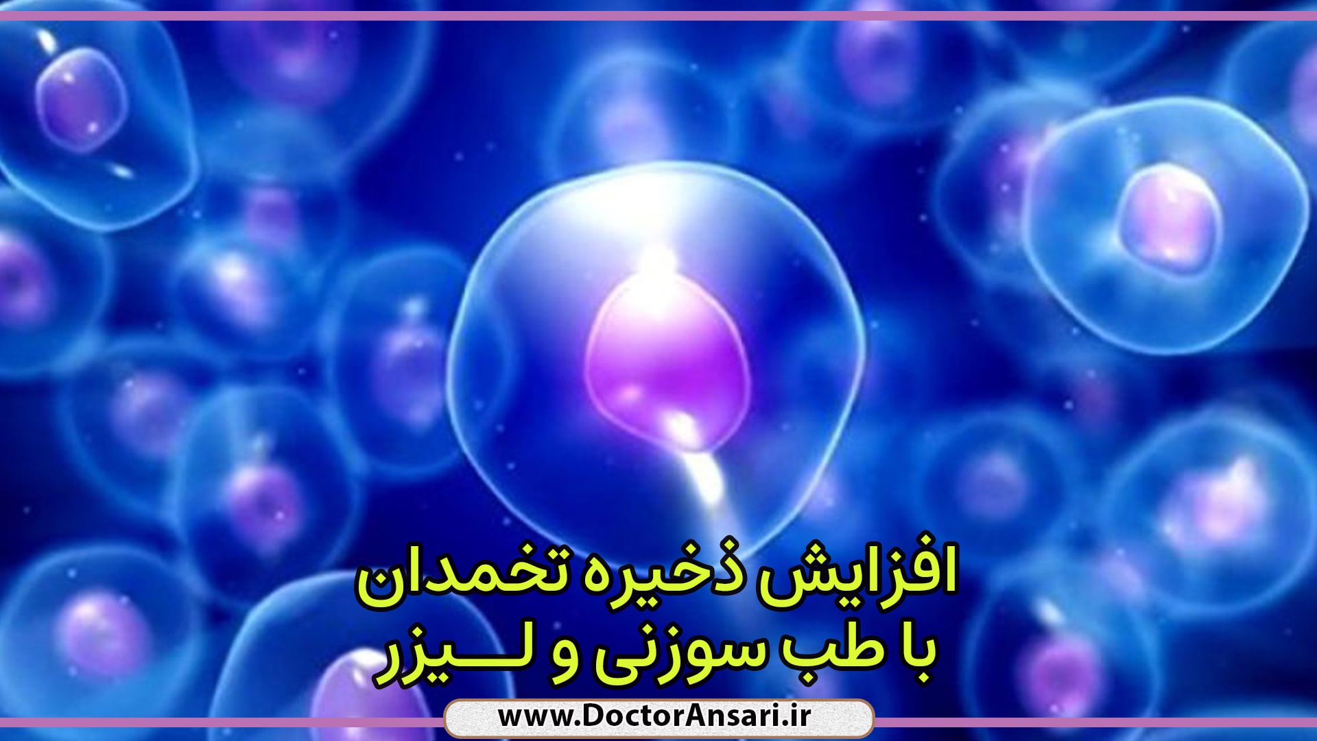 افزایش ذخیره تخمدان با لیزردرمانی کم توان