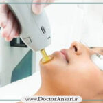 لیزر موهای زائد با دستگاه الکس کندلا در ونک لیزر موهای زائد با دستگاه الکس کندلا در ونک