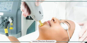 لیزر موهای زائد با دستگاه الکس کندلا در ونک لیزر موهای زائد با دستگاه الکس کندلا در ونک