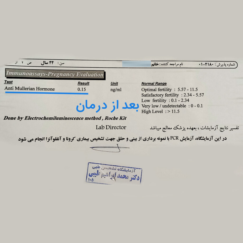 آزمایش AMH بعد از درمان با طب سوزنی لیزری دکتر انصاری