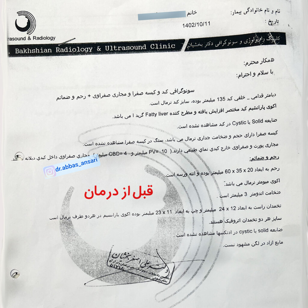 سونوگرافی ضخامت رحم- قبل از درمان با طب سوزنی