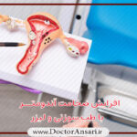 افزایش ضخامت آندومتر افزایش ضخامت آندومتر